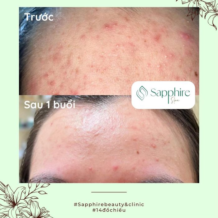 Không gian sang trọng tại Sapphire Spa - Ảnh 1