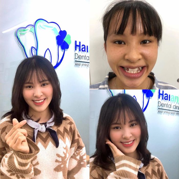 Nha Khoa Hải Anh - Hình ảnh 2