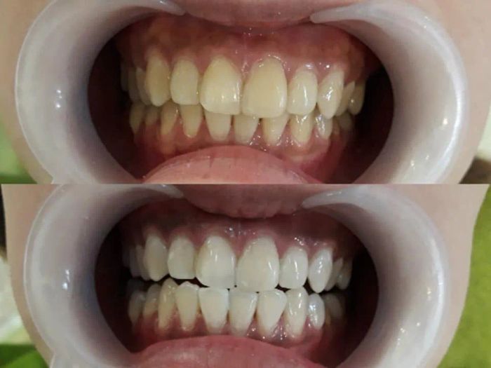 Nha Khoa Huyền Mỹ 4 ảnh 2