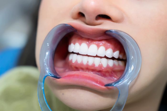 Nha Khoa Thẩm Mỹ SMILE ART - Hình ảnh 3