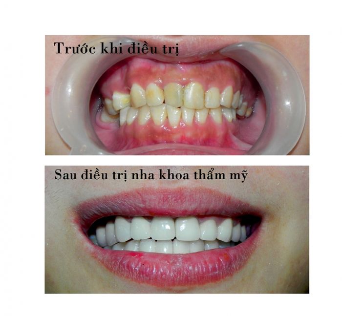 Nha Khoa Việt Khương - Hình ảnh 1