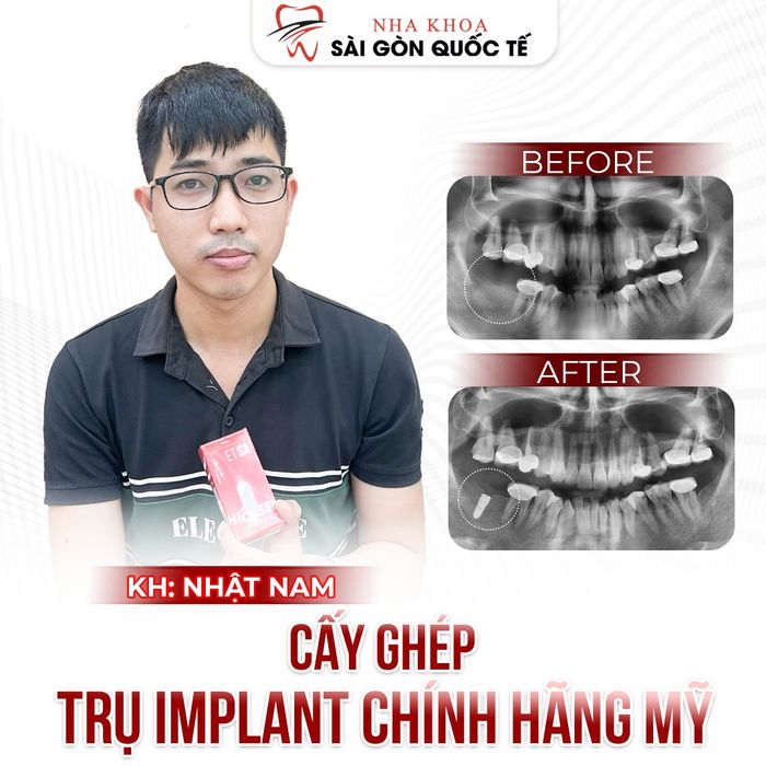 Hình ảnh cơ sở vật chất đạt chuẩn quốc tế tại Nha Khoa Sài Gòn Quốc Tế