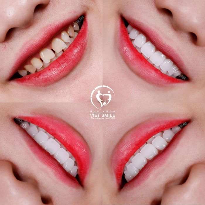 Không gian hiện đại tại Nha khoa VIET SMILE