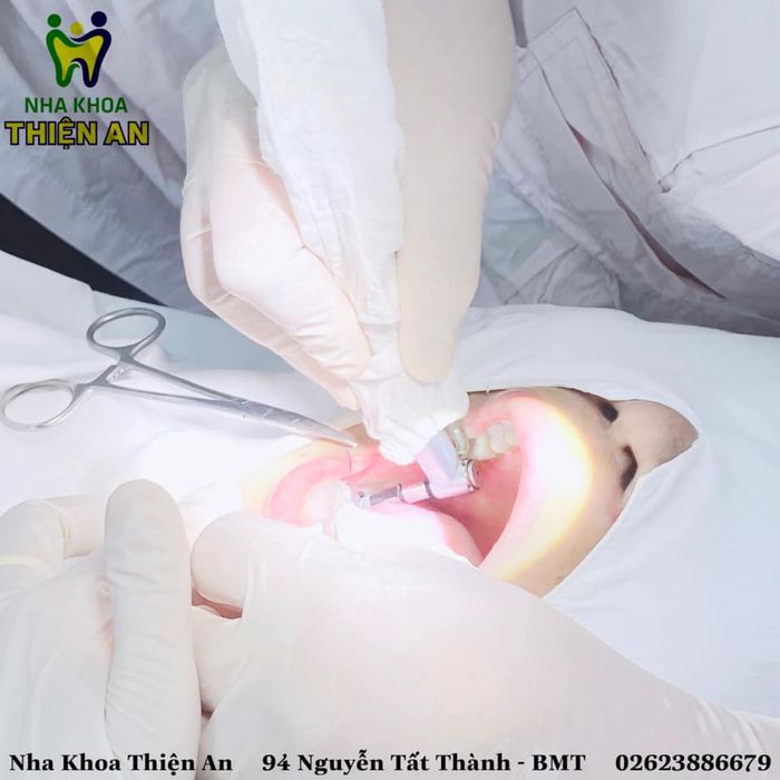 Hình ảnh đội ngũ bác sĩ chuyên nghiệp tại Nha Khoa Thiện An