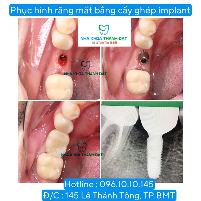 Không gian hiện đại và tiện nghi tại Nha Khoa Thành Đạt