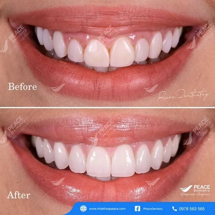 Không gian hiện đại tại Peace Dentistry