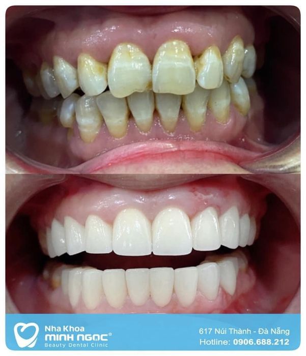 Nha Khoa MINH NGỌC - Beauty Dental Clinic Hình ảnh 1