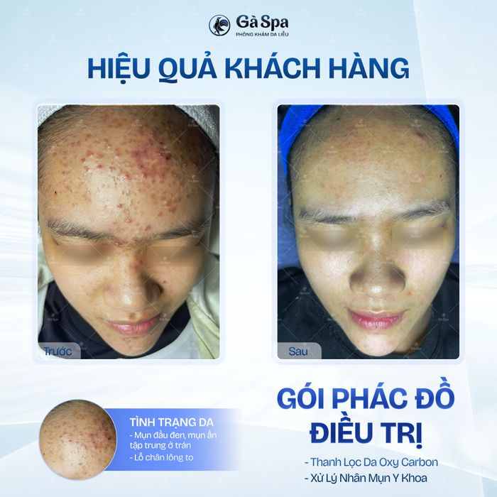 Hình ảnh không gian trị liệu tại Gà Spa