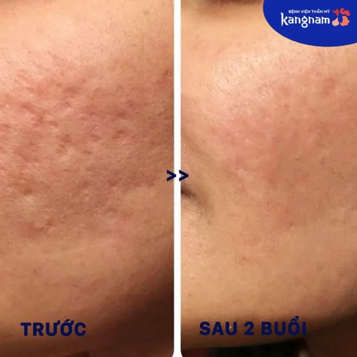 Hệ thống máy móc hiện đại nhập khẩu từ Hàn Quốc