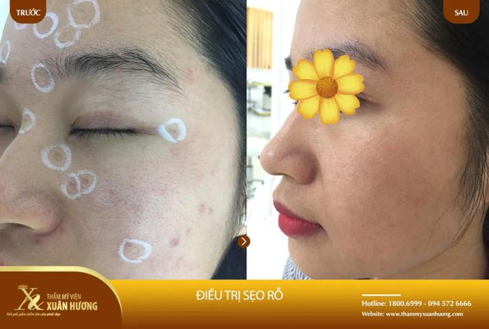Hệ thống máy móc hiện đại tại Bệnh Viện Thẩm Mỹ Xuân Hương