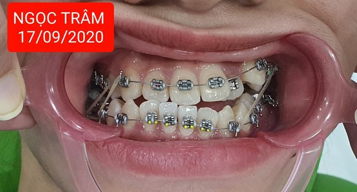 Nha Khoa Thẩm Mỹ Thanh Tú ảnh 2