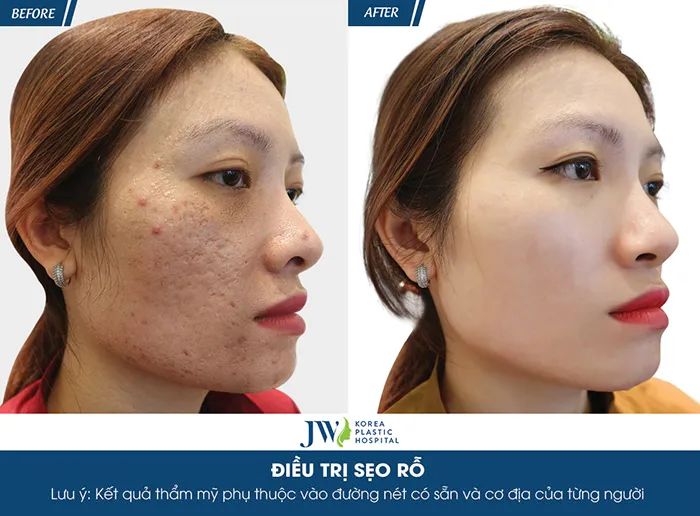 Không gian sang trọng chuẩn 5 sao tại Bệnh viện JW