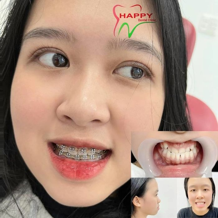Nha Khoa Thẩm Mỹ Happy ảnh 2