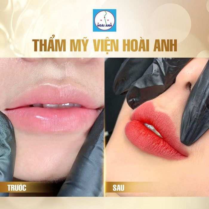 [Hình ảnh] Không gian điều trị cao cấp tại Thẩm mỹ viện Hoài Anh