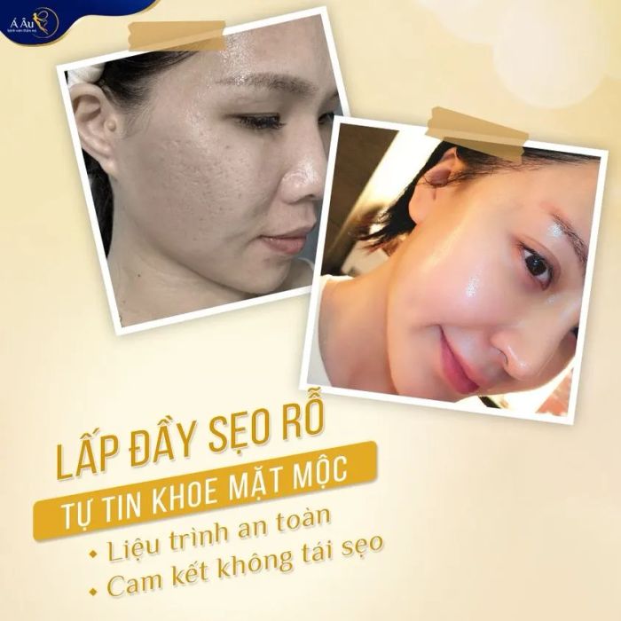 Không gian chuẩn 5 sao tại Bệnh Viện Thẩm Mỹ Á Âu