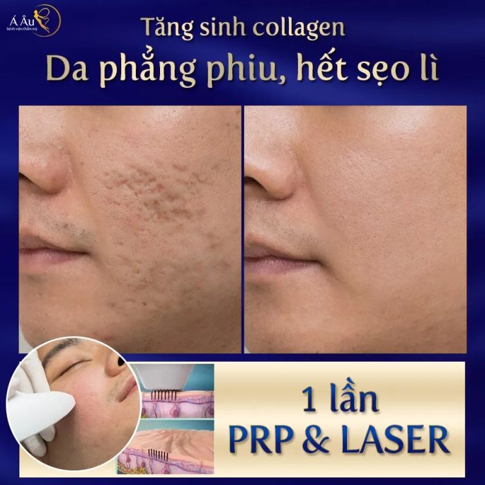 Hệ thống máy móc hiện đại tại Bệnh Viện Thẩm Mỹ Á Âu