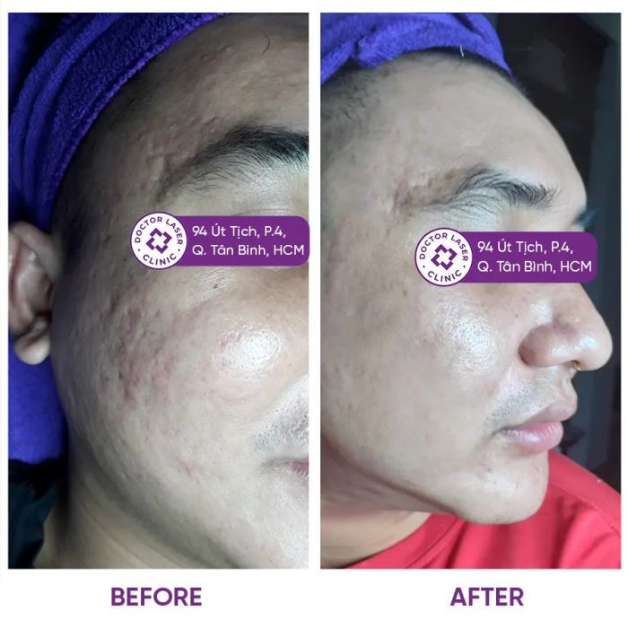 Hệ thống máy móc tân tiến tại Doctor Laser