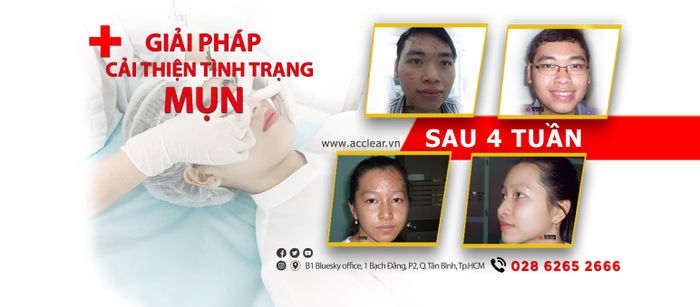 Hình ảnh không gian sang trọng tại ACCLEAR