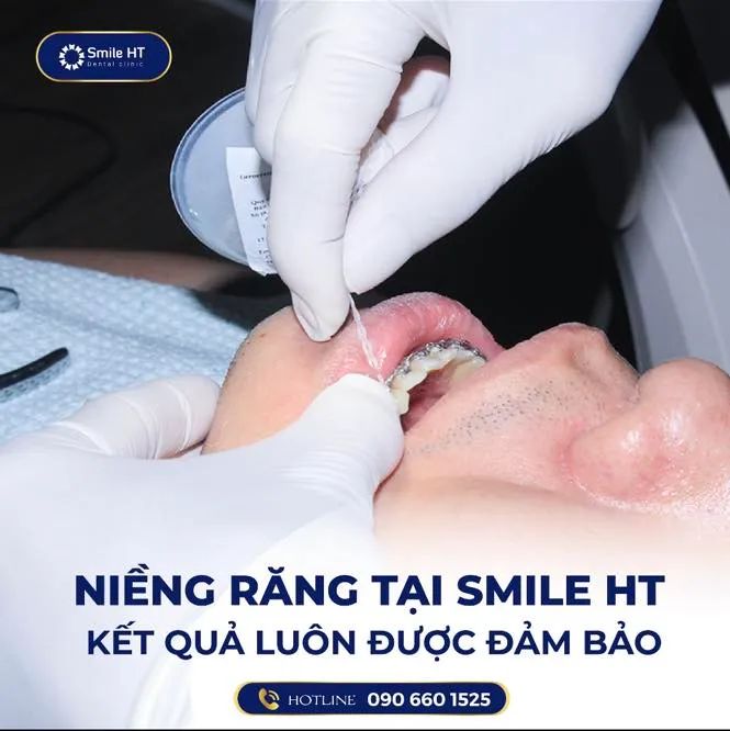 Nha Khoa Thẩm Mỹ Smile HT hình ảnh 2