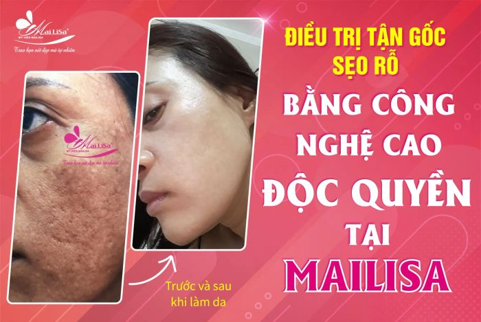 Không gian sang trọng tại Thẩm Mỹ Viện Mailisa