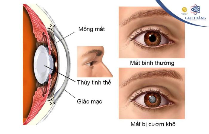 Bệnh Viện Mắt Cao Thắng ảnh 2