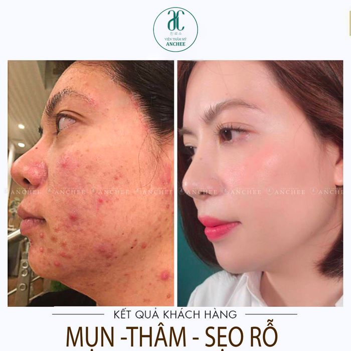 Hình ảnh phòng điều trị cao cấp tại AnChee Clinic