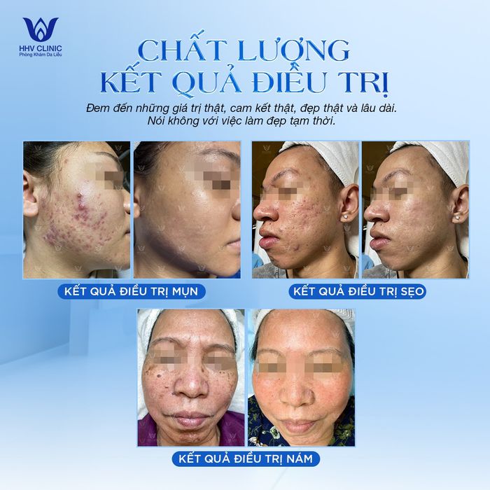 Hình ảnh không gian điều trị cao cấp tại HHV Clinic