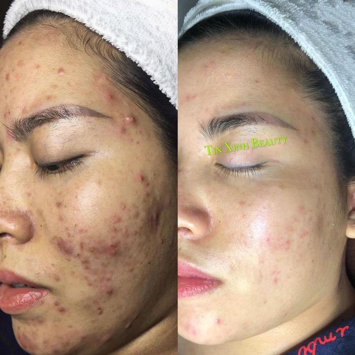 Không gian sang trọng và hiện đại tại Tin Xinh Beauty