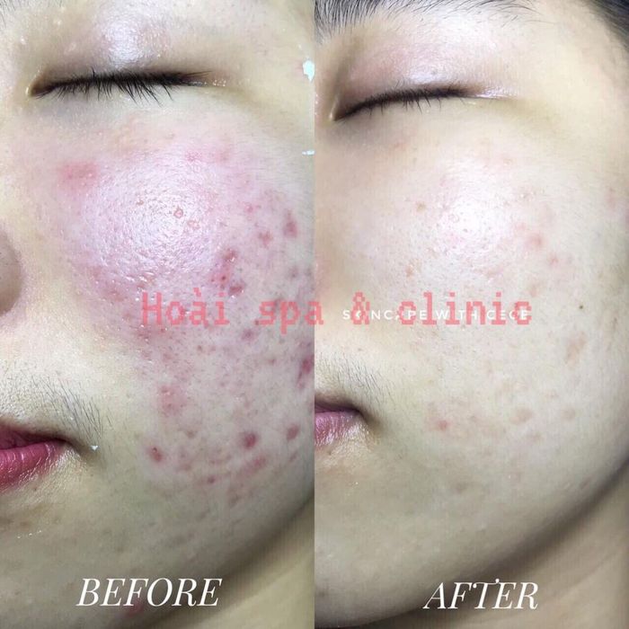 Không gian sang trọng và hiện đại tại Hoài Spa & Clinic