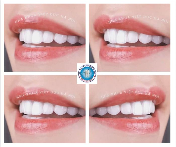 Hình ảnh không gian hiện đại tại Nha Khoa Việt Đức