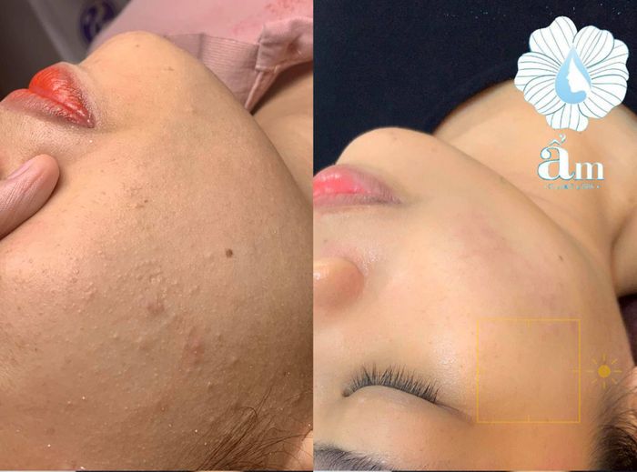 Không gian sang trọng và hiện đại tại Ẩm Clinic & Spa