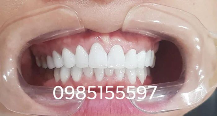 Không gian hiện đại tại Trung tâm Nha khoa Nụ Cười Duyên