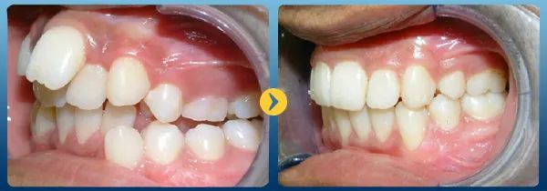 Hình ảnh thực tế Nha Khoa Quốc Tế Việt - Sing
