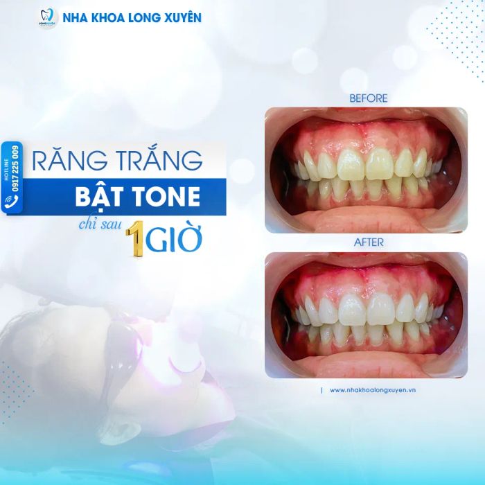 Hình ảnh đội ngũ bác sĩ tay nghề cao tại Nha Khoa Long Xuyên