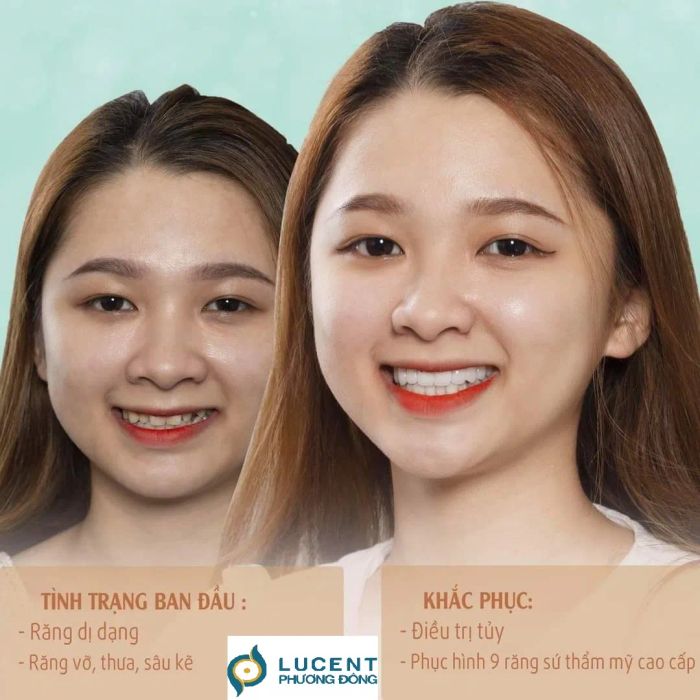 Không gian hiện đại tại Lucent Phương Đông Nha Khoa
