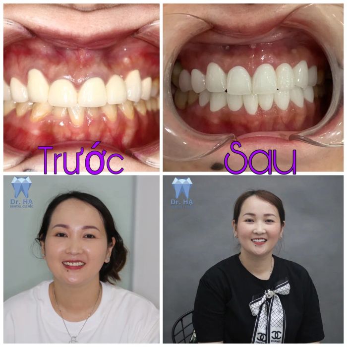 Không gian hiện đại và tiện nghi tại Nha Khoa Dr. HẠ - Long Xuyên