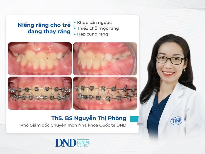 Không gian sang trọng đạt chuẩn châu Âu tại Nha khoa Quốc tế DND