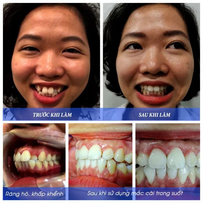 Không gian hiện đại và sang trọng tại Nha Khoa Úc Châu