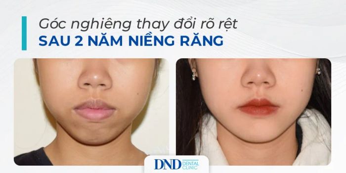 Hệ thống máy móc hiện đại tại Nha khoa Quốc tế DND