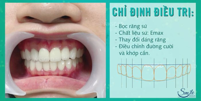 Không gian hiện đại tại Nha Khoa Sài Gòn Bình Dương