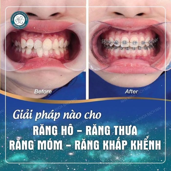 Hình ảnh cơ sở vật chất hiện đại tại Nha Khoa Quốc Tế Bạch Mai
