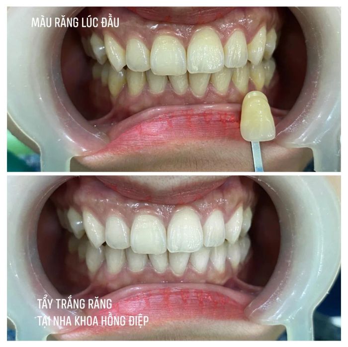 Nha khoa Hồng Điệp ảnh 1