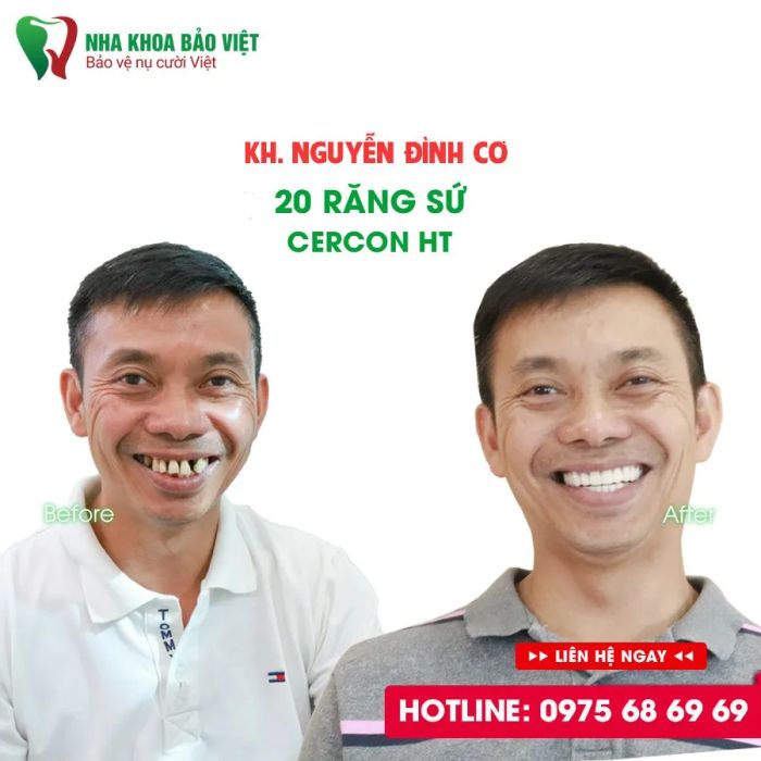 Không gian hiện đại tại Nha Khoa Bảo Việt