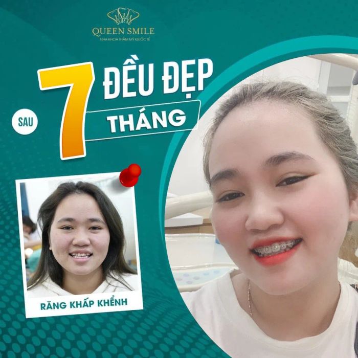 Không gian sang trọng và hiện đại tại Nha khoa thẩm mỹ Queen Smile