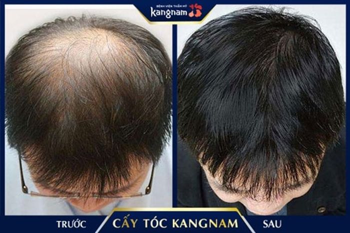 Hình ảnh Bệnh viện Thẩm mỹ Kangnam