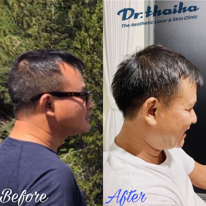 Kết quả điều trị thực tế tại DR Thái Hà
