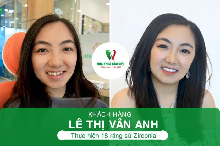 Hình ảnh thực tế tại Nha Khoa Bảo Việt