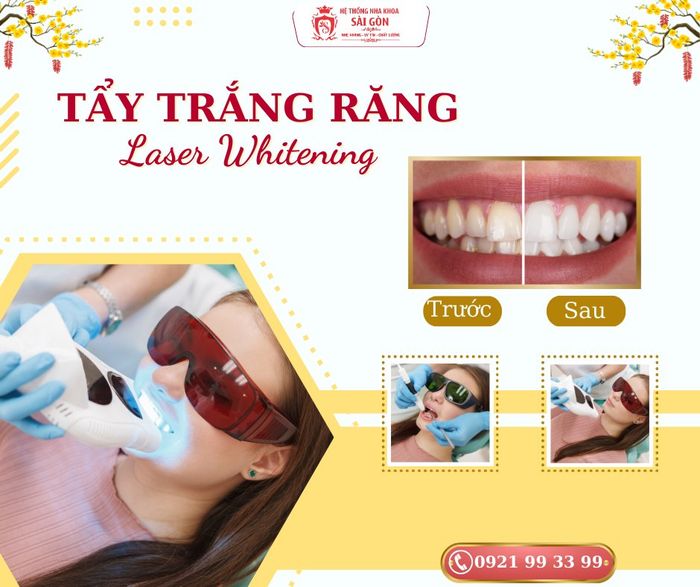 Nha Khoa Sài Gòn 16 ảnh 1