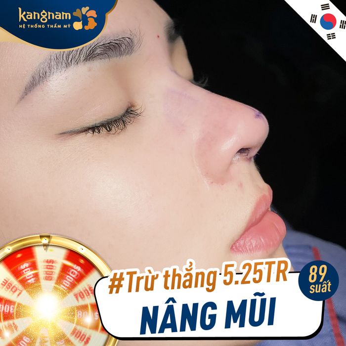 Hình ảnh thực tế Bệnh viện Kangnam - Phòng phẫu thuật vô trùng