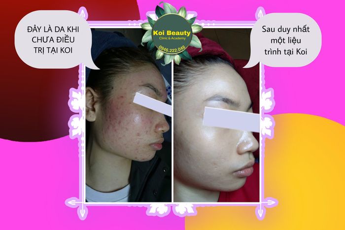 Không gian sang trọng chuẩn phòng khám tại Koi Beauty Spa